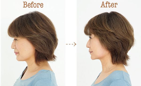 頭皮が柔らかくなってきたのを実感しました