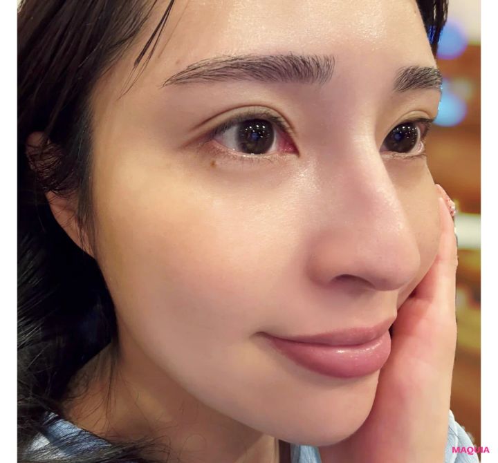 2026年3月4月 おすすめ最新作コスメ 3月25日（水）発売 ダーマレーザー スーパーブラックVC 使用感