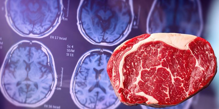 肉を多く食べていると遺伝的にアルツハイマー病になりやすい人も認知症リスクが低くなっていた