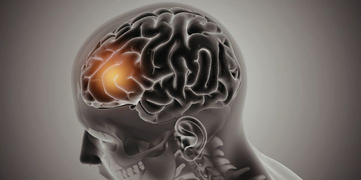 高リスク遺伝子を跳ね返す個人のための「食」