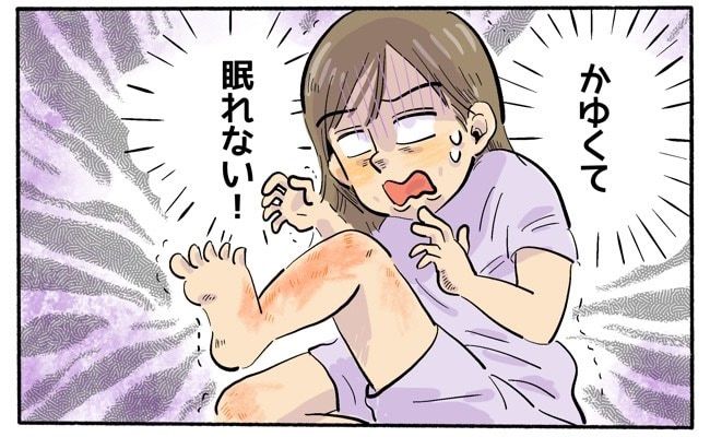 痒みに悩む女性