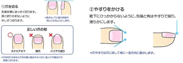 正しい爪の形のポイント