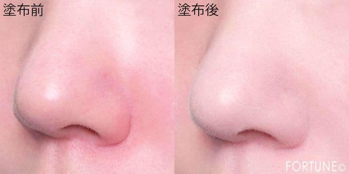 肌なやみ図鑑 『肌なやみ図鑑 赤鼻ジェル』