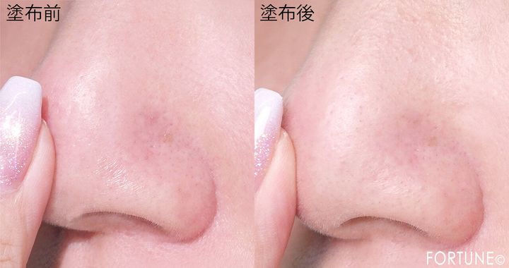 肌なやみ図鑑 『肌なやみ図鑑 黒鼻ジェル』