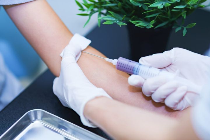 健康診断で採血後、「あざ」ができる人の特徴とは（画像はイメージ）