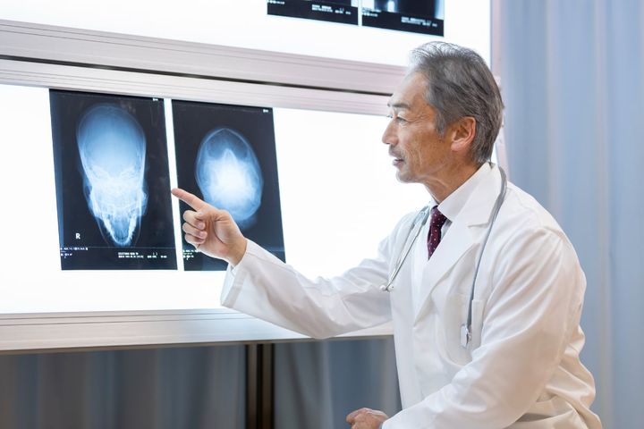 脳腫瘍は完治できる？（画像はイメージ）