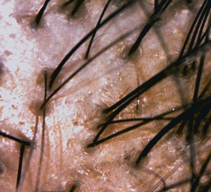 頭頂部画像before