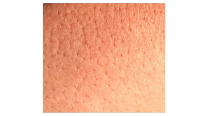 シャクティスキン