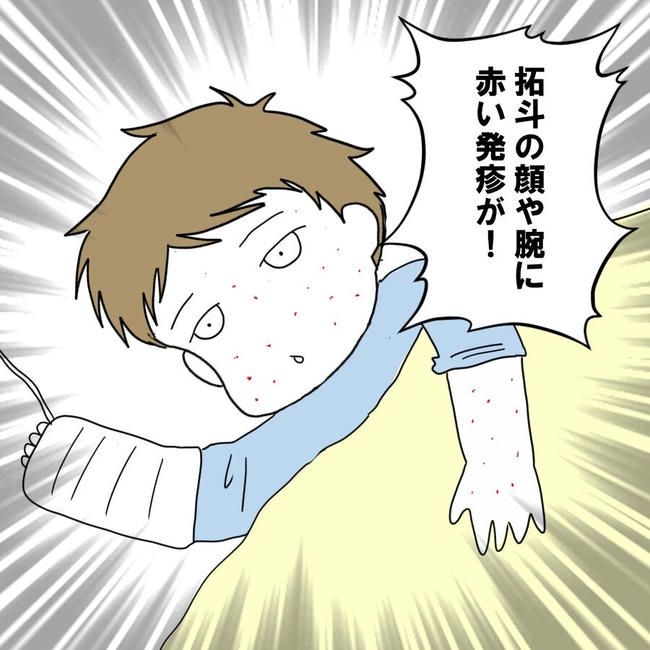 子どもが入院しても付き添いはワンオペ／紙屋束実