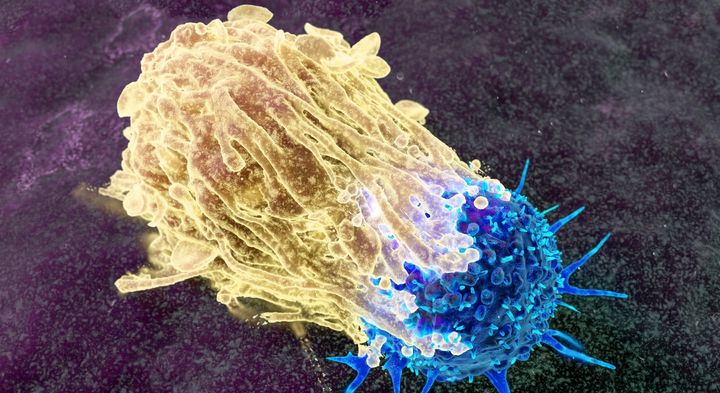 CAR-Tという、改造された追跡型の部隊