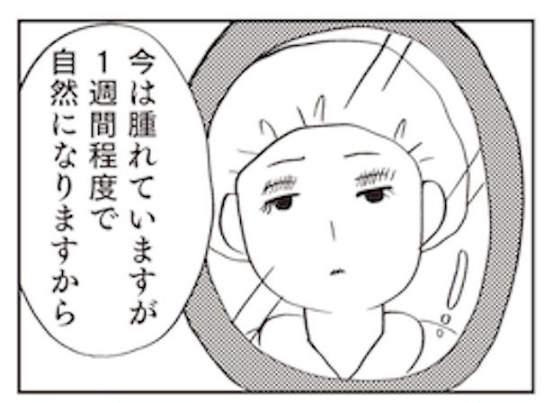 「親に整形させられた私が母になる エリカの場合」2 画像提供：(C)グラハム子