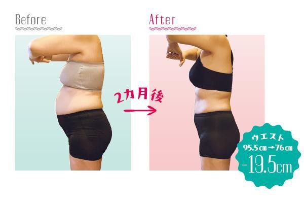 50代でもこんなに変わった！体験者のBefore→After 