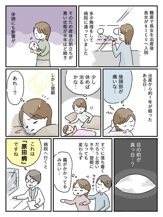 原田病の体験談