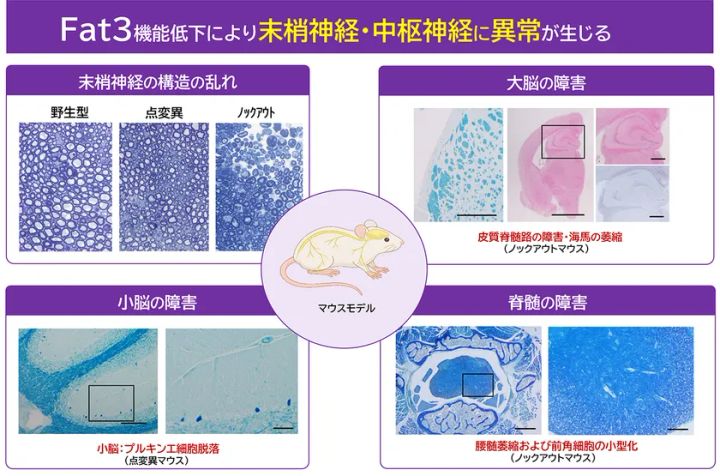 マウスモデルで末梢神経や脊髄、大脳、小脳に広範な神経障害が確認されたことを示す図