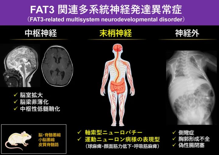 FAT3遺伝子の異常により脳や末梢神経、骨格にわたる多系統の障害が生じることを示した図