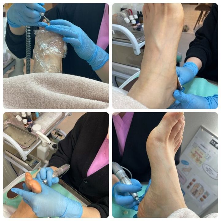 フットケア、してますか？