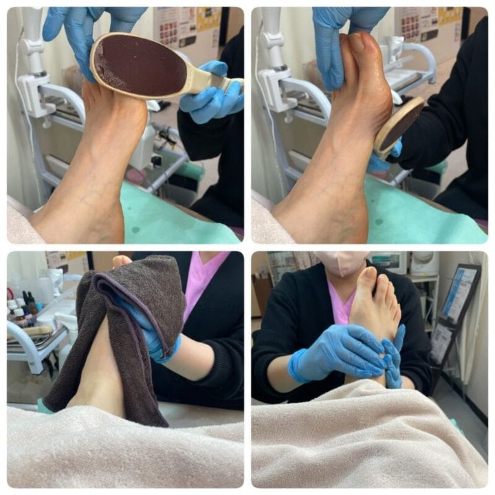 かかとはしっかりとケアしてから夏を迎えたい