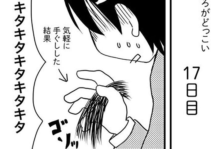 抗がん剤副作用の脱毛はいつから？【乳癌日記 #16】