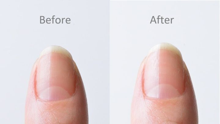 100均の「つめみがき」おすすめ8選！ピカピカになるのはどれ？