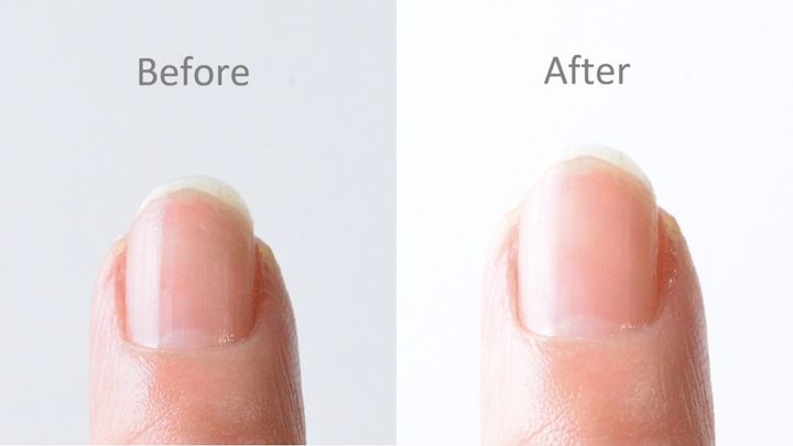 100均の「つめみがき」おすすめ8選！ピカピカになるのはどれ？