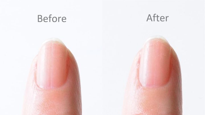 100均の「つめみがき」おすすめ8選！ピカピカになるのはどれ？