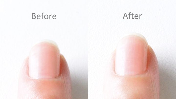 100均の「つめみがき」おすすめ8選！ピカピカになるのはどれ？