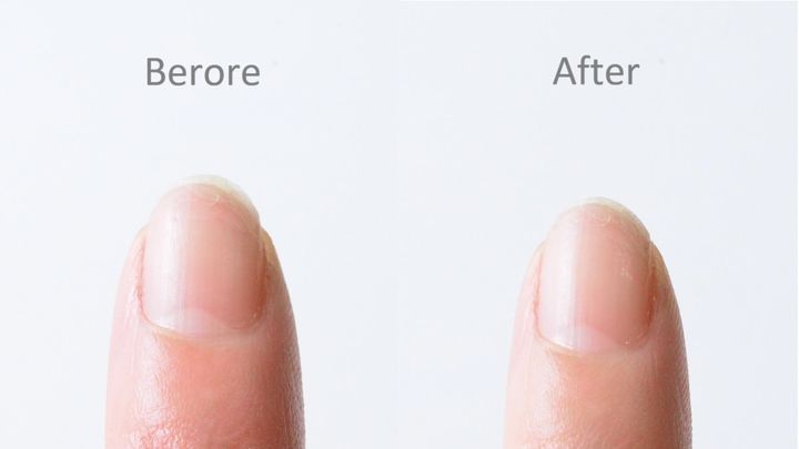 100均の「つめみがき」おすすめ8選！ピカピカになるのはどれ？