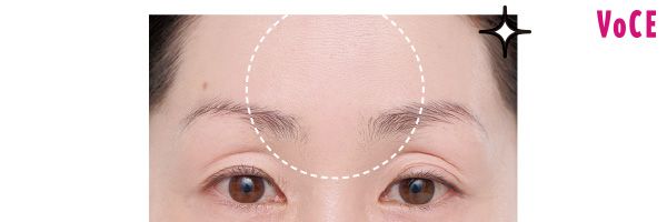 全箇所から毛穴が消えた⁉