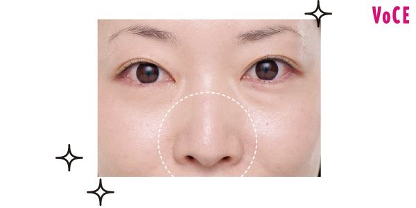 鼻も頰も、毛穴よ、いずこへ!?