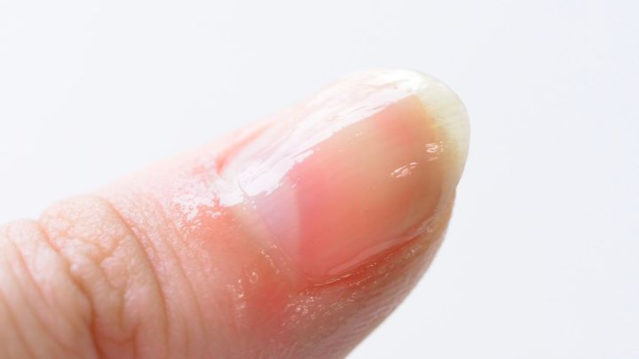 100均【セリア】キューティクルリムーバーを試したら…もう手放せない！