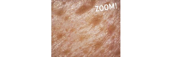たるみ毛穴悩みは……／ZOOM！