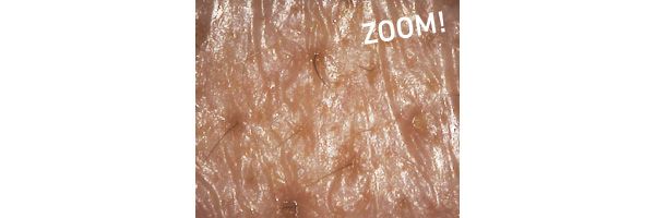 たるみ毛穴悩みは……／ZOOM！