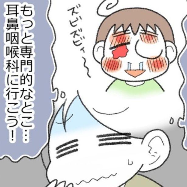 アレルギーのかゆみで顔をこすり、酷い有様になってしまった息子。自身も過去に同じような経験をしたこともあり、専門的な治療を受けさせようと決めた。 画像提供：エェコ(@nakiri_aik)