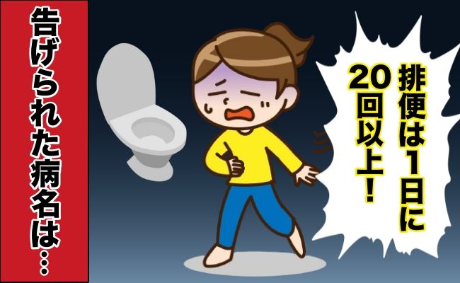 潰瘍性大腸炎 イメージカット