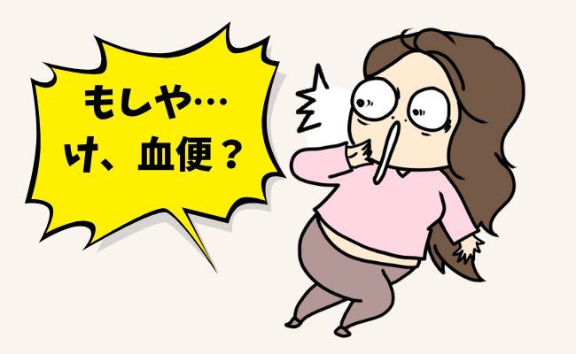 潰瘍性大腸炎 イメージカット