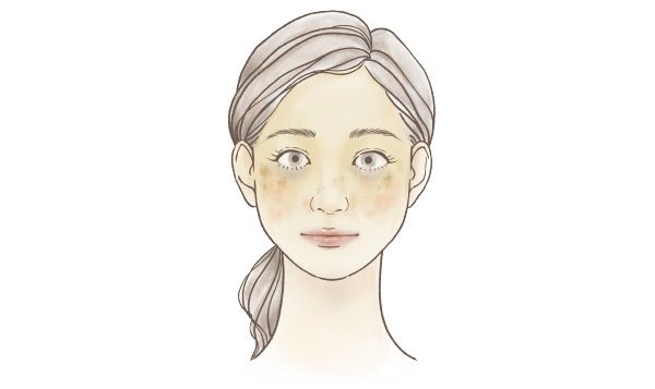 大人の肌が直面する色ムラ