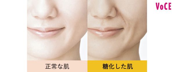 【左】正常な肌 【右】糖化した肌