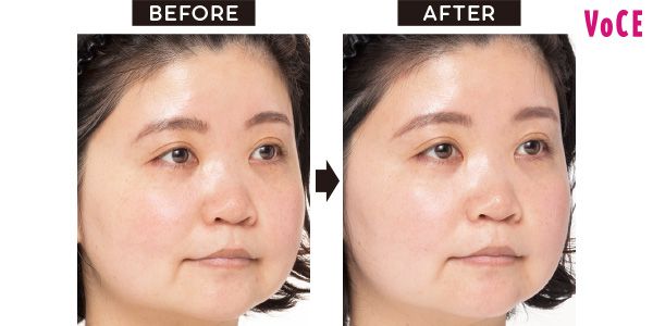 VOCEアンバサダー べっちさん BEFORE→AFTER