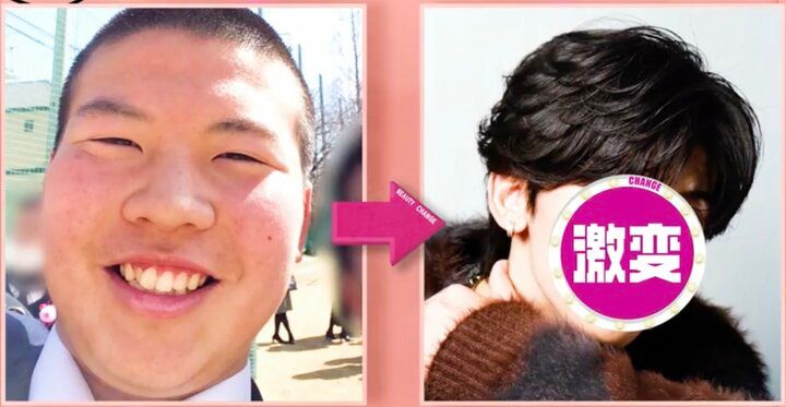 【写真・画像】41kg減で「おにぎり君」→Number_i神宮寺勇太似イケメンに！衝撃ビフォーアフターに「別人じゃん！」「無整形なの！？」驚きの声 1枚目