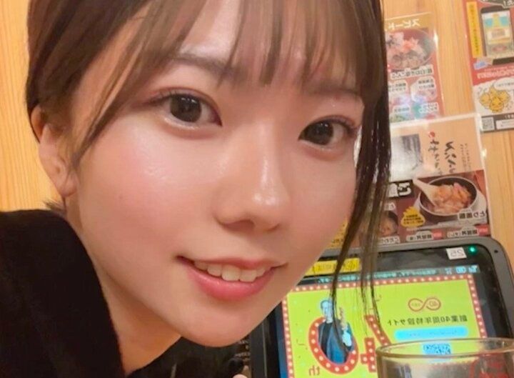 【写真・画像】「69キロ→45キロ」女優を目指す美人女子大生、24キロ減の過激ダイエットを告白「栄養不足で気を失い顔を6針縫った」 1枚目