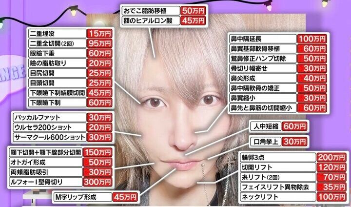 【写真・画像】「整形総額2000万円」元引きこもりのバンドマン、費用の出所を赤裸々告白「ちょっと言いにくいですけど…」 1枚目