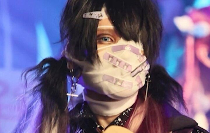 【写真・画像】整形2日後にライブ強行！ 包帯姿でベースを弾くV系バンドマンの姿に衝撃 1枚目