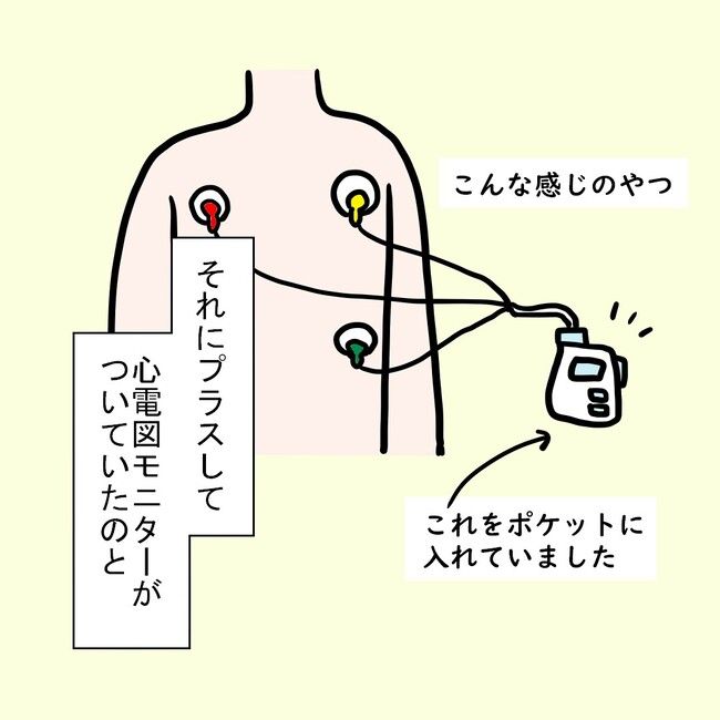 27歳第2子妊娠中に不整脈／萩原さとこ