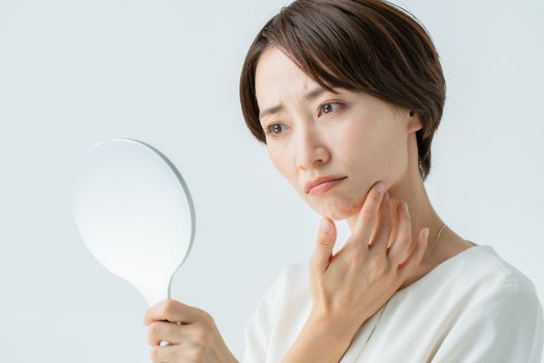 口角が下がる原因
