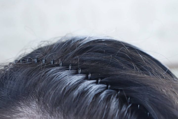 ワイヤーカチューシャ コイル製 使用例