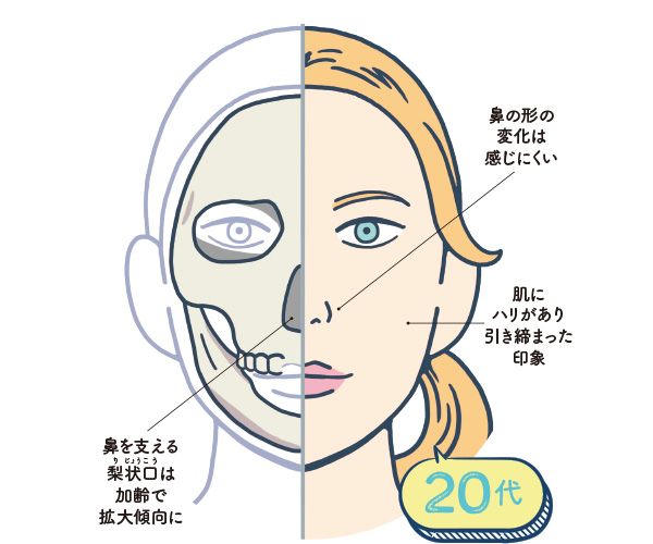 20代 鼻の形の変化は感じにくい 肌にハリがあり引き締まった印象 鼻を支える梨状口（りじょうこう）は加齢で拡大傾向に