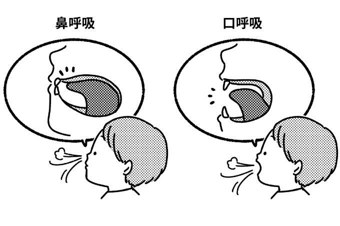 【子どもの歯科矯正Q&A】「どうして歯並びが悪くなっちゃうの？」小児歯科矯正のベテラン先生がおこたえします！の画像1