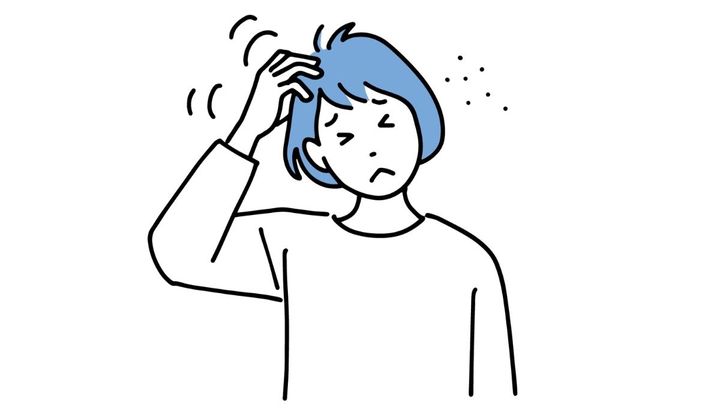 頭をかく女性のイラスト