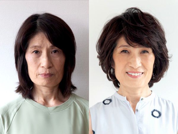 イメチェンアフター写真（フロント）：ひし形カットで面長・エラ張り・ハチ張りが解決