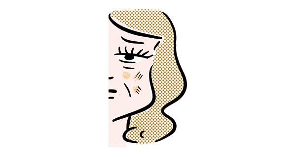ハリ低下